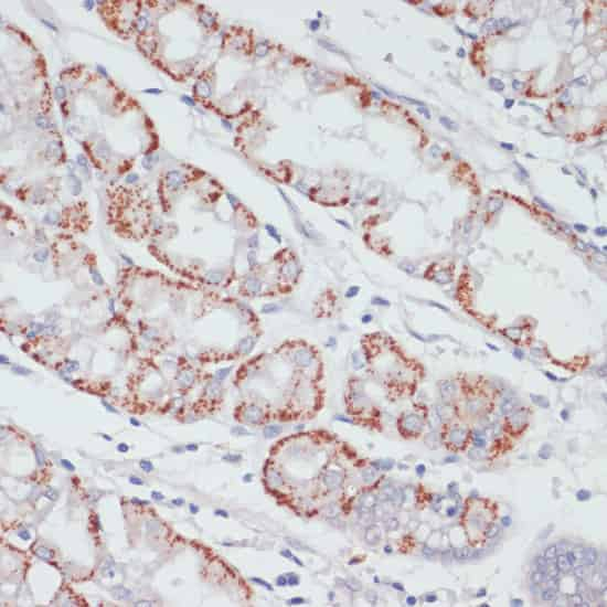 Immunohistochemistry of paraffin-embedded Human stomach using ACSL3 Polyclonal Antibody at dilution of  1:100 (40x lens).