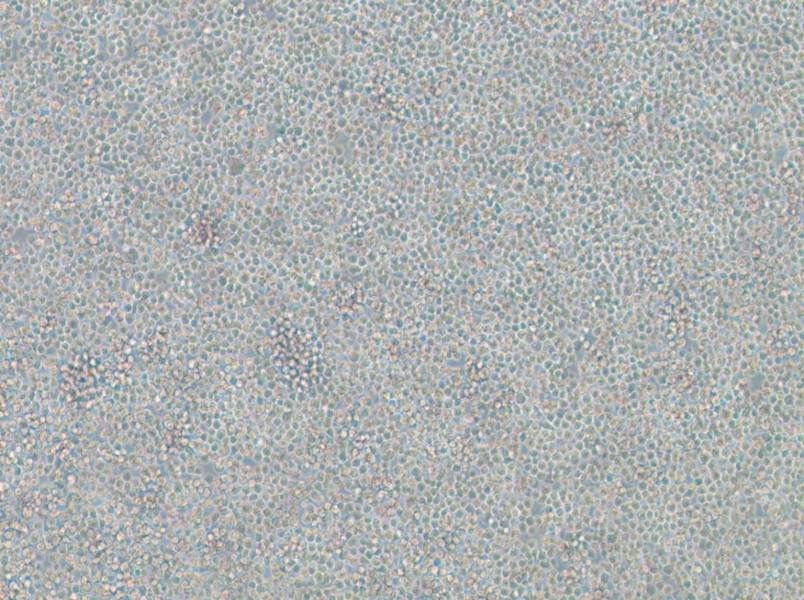 WIL2 S Cell Complete Medium - 3