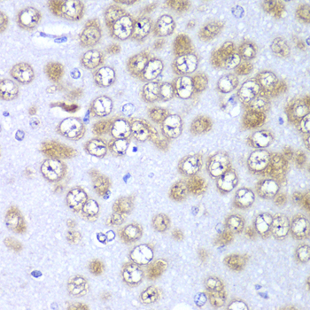 Immunohistochemistry of paraffin-embedded Rat brain using RPS10 Polyclonal Antibody at dilution of 1:100 (40x lens).