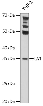 Western blot analysis of extracts of THP-1 cells using LAT Polyclonal Antibodyat 1:1000 dilution.