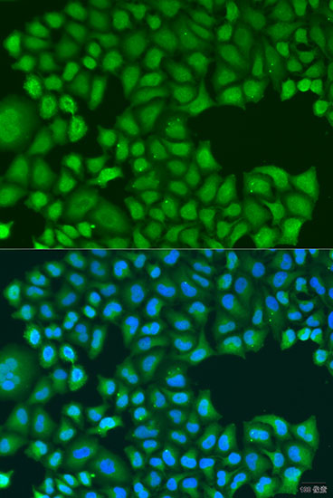 Immunofluorescence analysis of U2OS cells using TIRAP Polyclonal Antibody at dilution of 1:100. Blue: DAPI for nuclear staining.