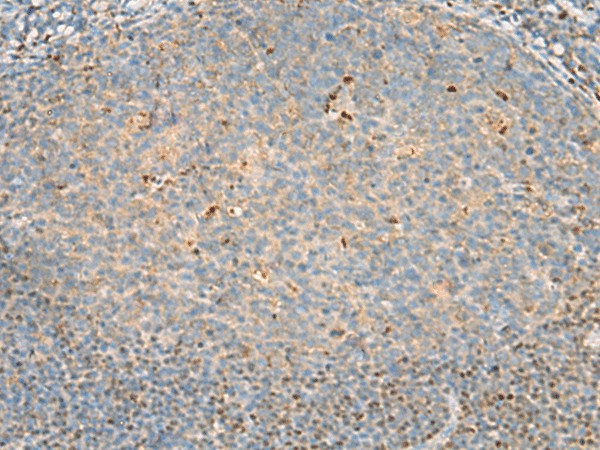 Immunohistochemistry of paraffin-embedded Human tonsil tissue  using DNPEP Polyclonal Antibody at dilution of 1:60(?200)