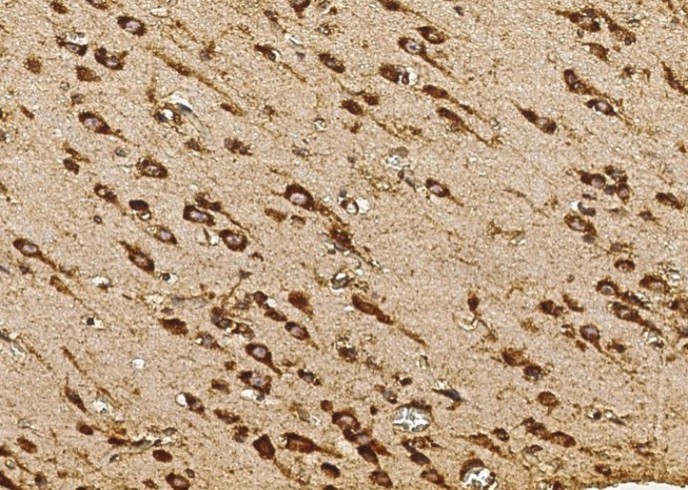Recombinant SULT1A1 Monoclonal Antibody - small - 3