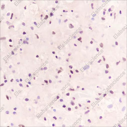 Recombinant SOX11 Monoclonal Antibody - 1