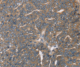HSD17B12 Polyclonal Antibody - 2