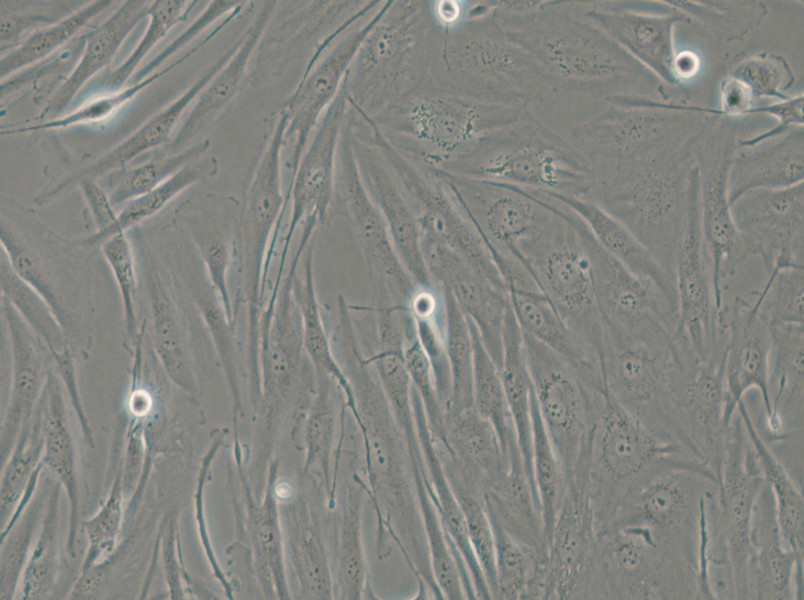 FTC-133 Cell Complete Medium - small - 4