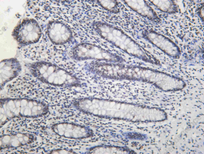 Recombinant DHX9 Monoclonal Antibody - 1