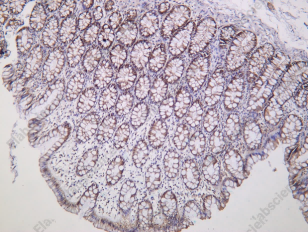 Recombinant STX17 Monoclonal Antibody - 1