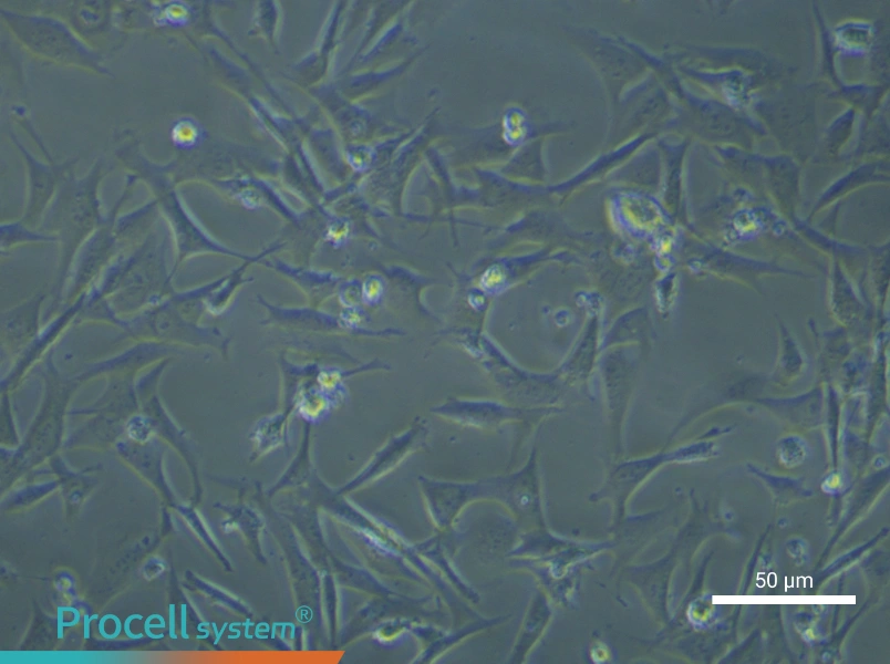 Mouse Hepatic Stellate Cells (Primary cell immortalization) - 5