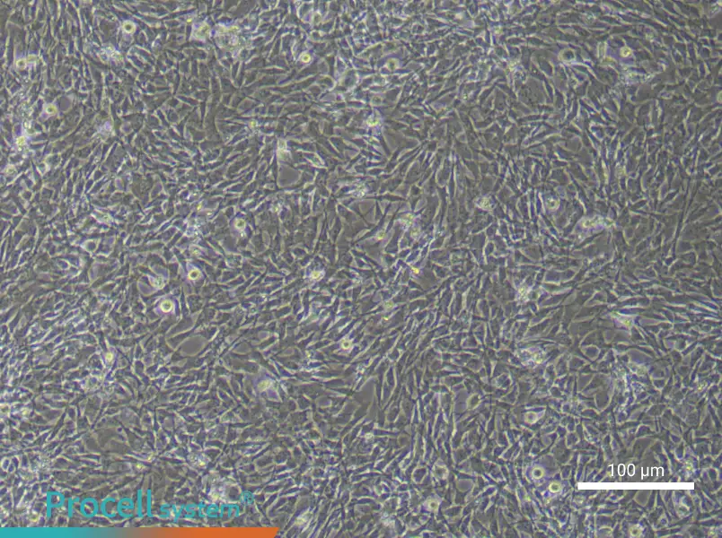 Mouse Bone Marrow Mesenchymal Stem (Primary cell immortalization) Cell Complete Medium - 1