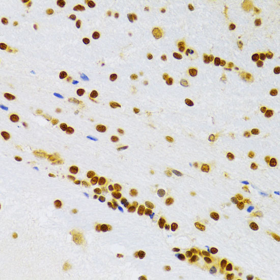 Immunohistochemistry of paraffin-embedded rat brain using HMGB1 Polyclonal Antibody at dilution of 1:100 (40x lens).Perform microwave antigen retrieval with 10 mM PBS buffer pH 7.2 before commencing with IHC staining protocol.