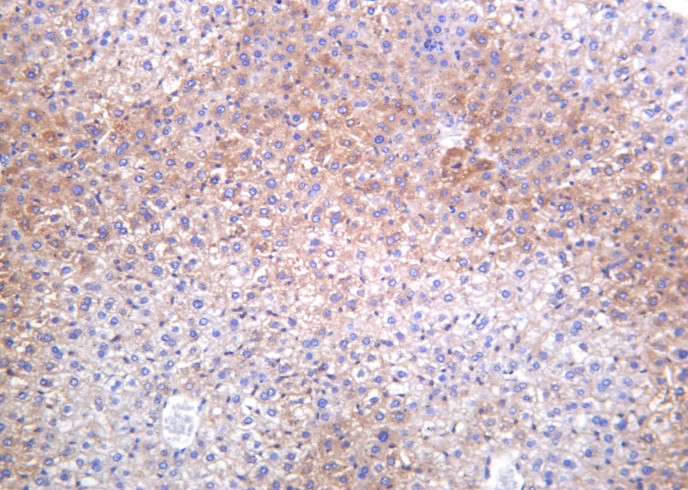 Recombinant Phospho-Acetyl-CoA Carboxylase (Ser79) Monoclonal Antibody - small - 2