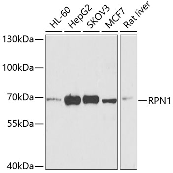 Western blot analysis of extracts of various cell lines using RPN1 Polyclonal Antibody at 1:1000 dilution.