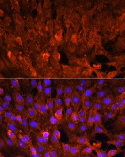 Immunofluorescence analysis of C6 cells using CISH Polyclonal Antibody at dilution of  1:100. Blue: DAPI for nuclear staining.