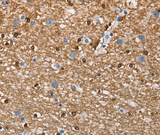 Immunohistochemistry of paraffin-embedded Human brain  tissue using CEACAM6 Polyclonal Antibody at dilution 1:70