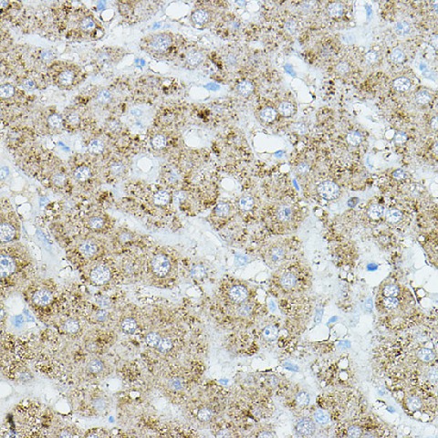 Immunohistochemistry of paraffin-embedded human liver using EIF2AK1 Polyclonal Antibody at dilution of 1:500 (40x lens).Perform high pressure antigen retrieval with 10 mM citrate buffer pH 6.0 before commencing with IHC staining protocol.