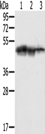 Western Blot analysis of Hepg2, K562 and Jurkat cell using SMARCB1 Polyclonal Antibody at dilution of 1:400