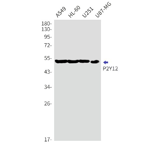 Western blot detection of P2Y12 in A549,HL-60,U251,U87-MG cell lysates using P2Y12 Rabbit mAb(1:1000 diluted).Predicted band size:40kDa.Observed band size:52kDa.