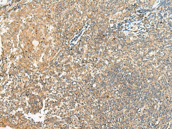 Immunohistochemistry of paraffin-embedded Human tonsil tissue  using HEBP1 Polyclonal Antibody at dilution of 1:40(?200)