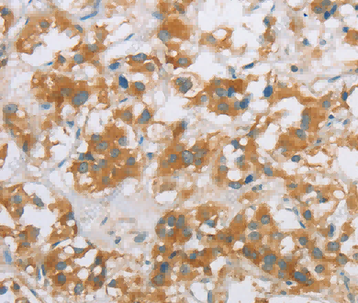 CYP2E1 Polyclonal Antibody - 2