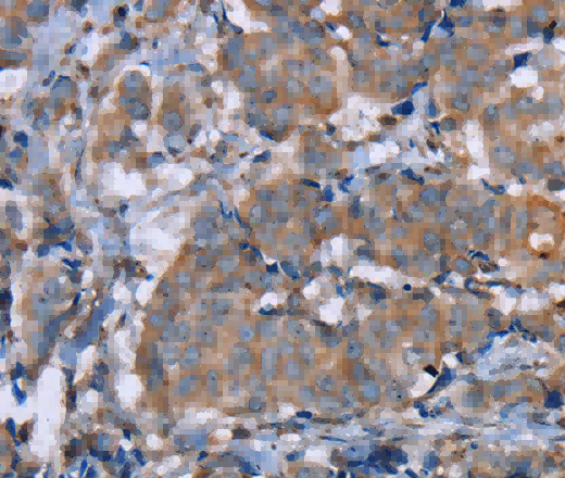 PON1 Polyclonal Antibody - 3