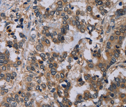 NECTIN4 Polyclonal Antibody - 2