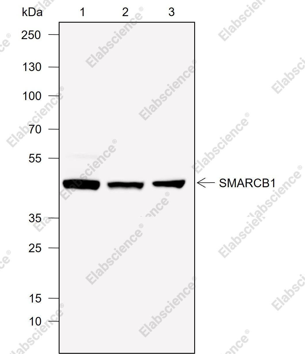 Recombinant SMARCB1/BAF47 Monoclonal Antibody - 1