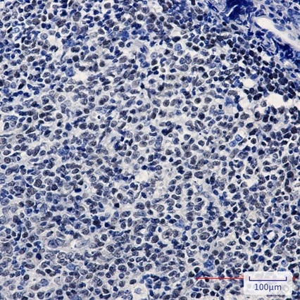 Recombinant KAT1/HAT1 Monoclonal Antibody - 2