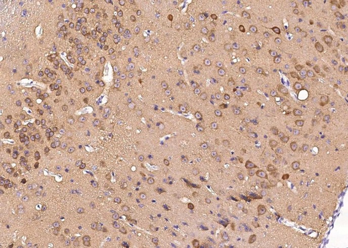 Recombinant S100A5 Monoclonal Antibody-searchlist-1