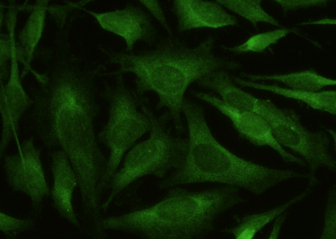 Recombinant BACE1 Monoclonal Antibody