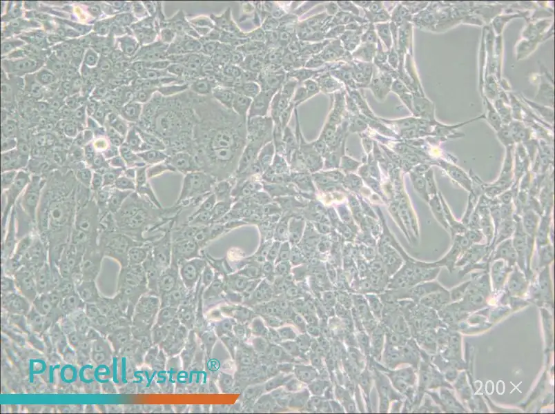 Renca [RenCa] Cell Complete Medium - small - 4