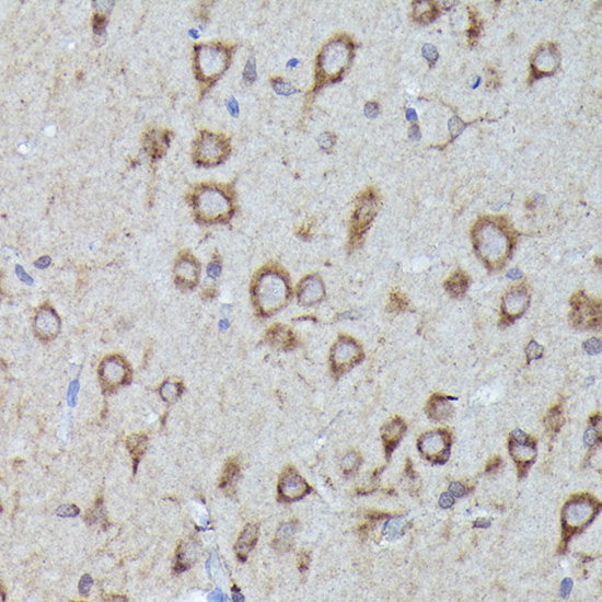 Immunohistochemistry of paraffin-embedded rat brain using LGR5/GPR49 Polyclonal Antibody at dilution of 1:300 (40x lens).Perform high pressure antigen retrieval with 10 mM citrate buffer pH 6.0 before commencing with IHC staining protocol.