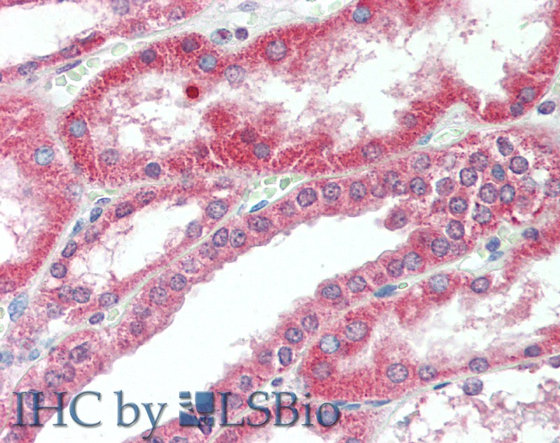 Immunohistochemistry of paraffin-embedded Kidney tissue using PKD1 Polyclonal Antibody at dilution of 1:60(Elabscience Product Detected by Lifespan).