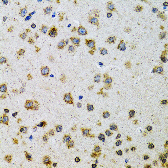 Immunohistochemistry of paraffin-embedded Rat brain using PDYN Polyclonal Antibody at dilution of 1:100 (40x lens).