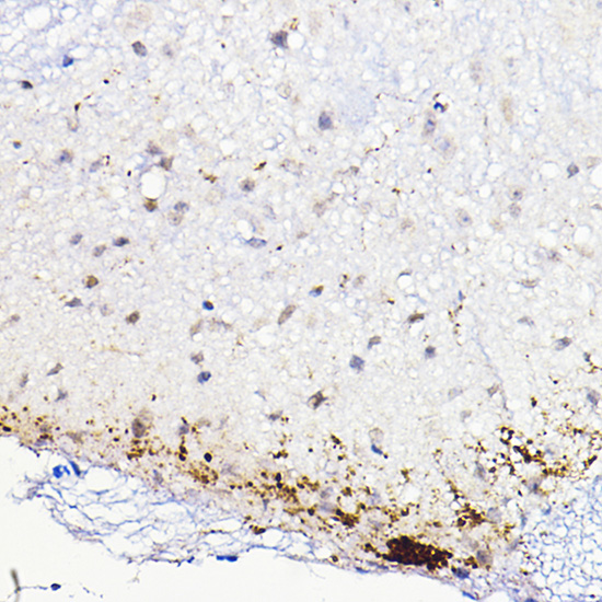 Immunohistochemistry of paraffin-embedded mouse spinal cord using CALCA Polyclonal Antibody at dilution of 1:100 (40x lens).Perform high pressure antigen retrieval with 10 mM citrate buffer pH 6.0 before commencing with IHC staining protocol.