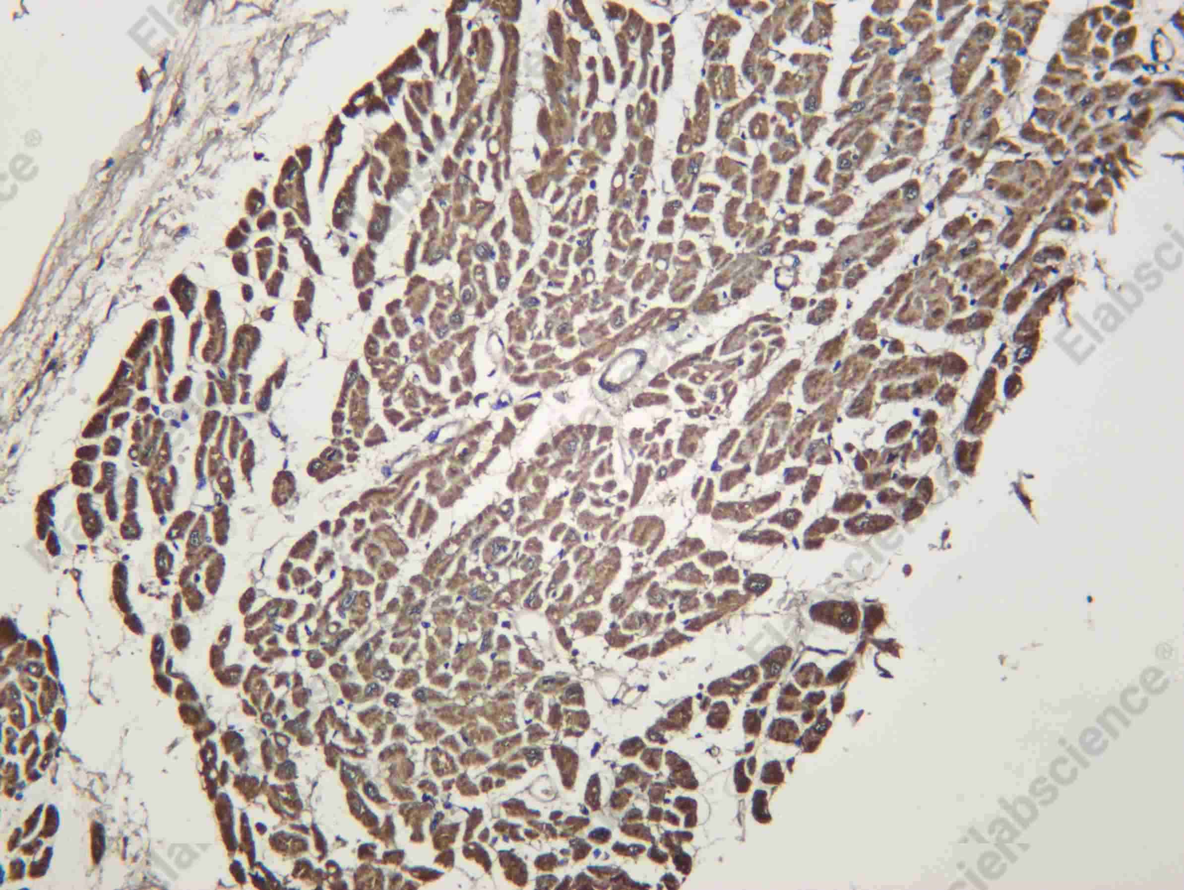 Recombinant AATC Monoclonal Antibody - 1
