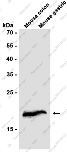 Recombinant Presenilin 1 Monoclonal Antibody - 2