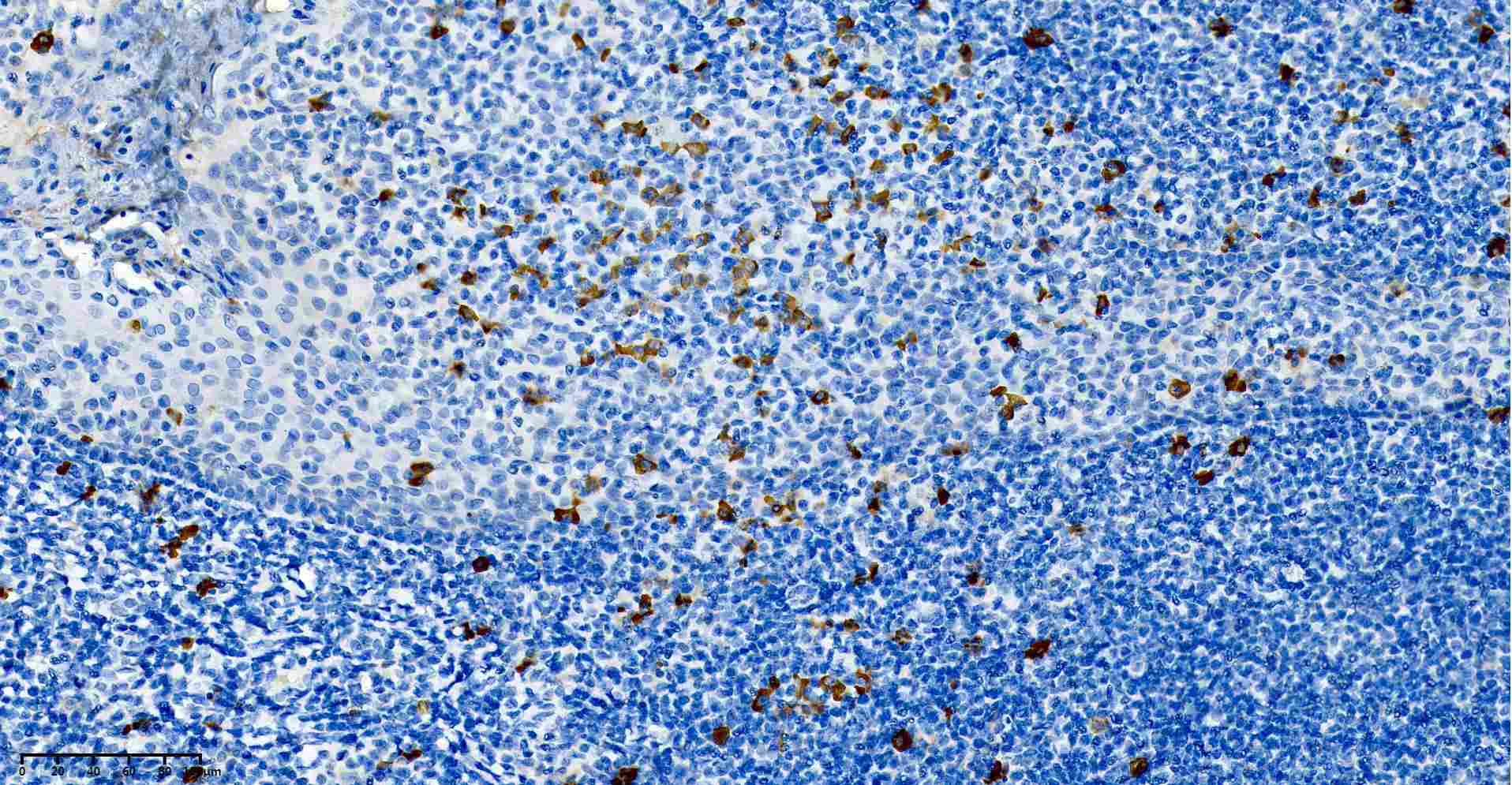 Recombinant Bax Monoclonal Antibody - small - 8