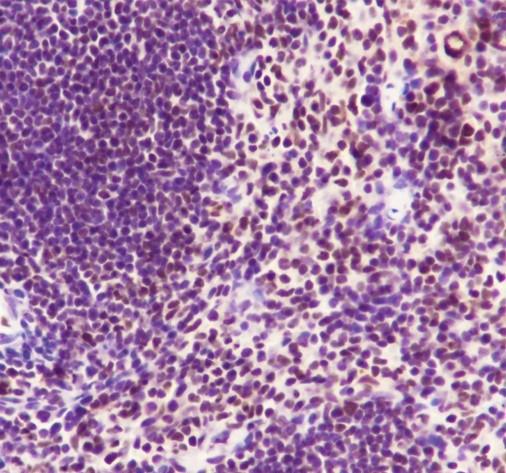 Recombinant SA2 Monoclonal Antibody - small - 4