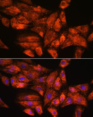 Immunofluorescence analysis of H9C2 cells using PPP1R15A Polyclonal Antibody at dilution of 1:100. Blue: DAPI for nuclear staining.