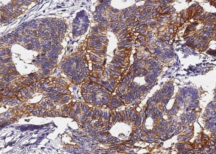 Recombinant GPA33 Monoclonal Antibody - small - 3