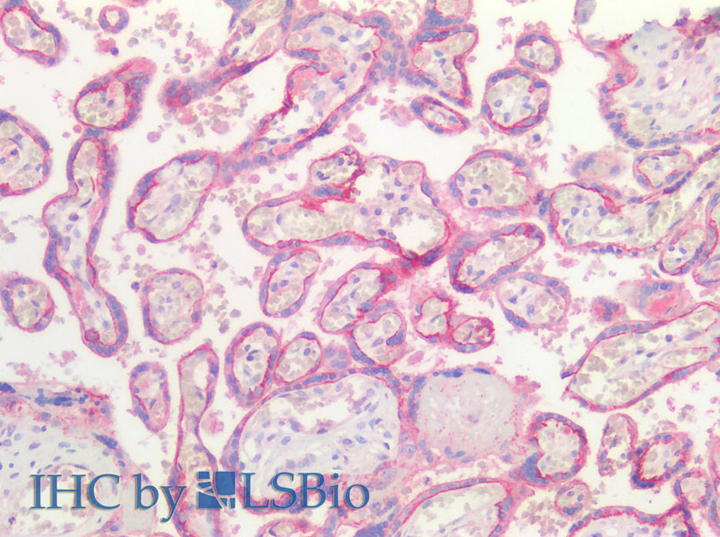 Immunohistochemistry of paraffin-embedded Human Placenta using E-Cadherin Polyclonal Antibody at dilution of 1:100(Elabscience Product Detected by Lifespan).