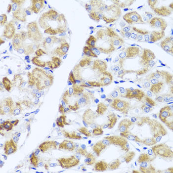 Immunohistochemistry of paraffin-embedded Human stomach using PIK3CA Polyclonal Antibody at dilution of 1:100 (40x lens).