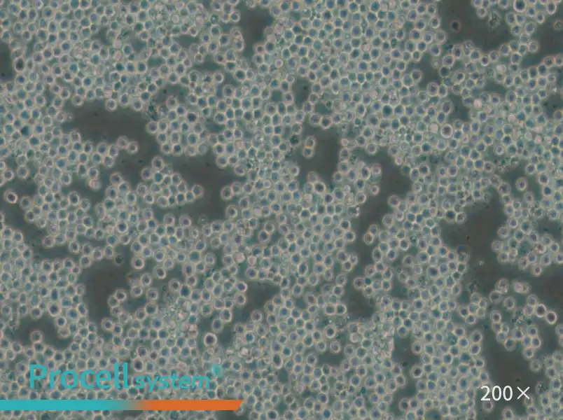 P3/NSI/1-Ag4-1 [NS-1] Cell Complete Medium - small - 5