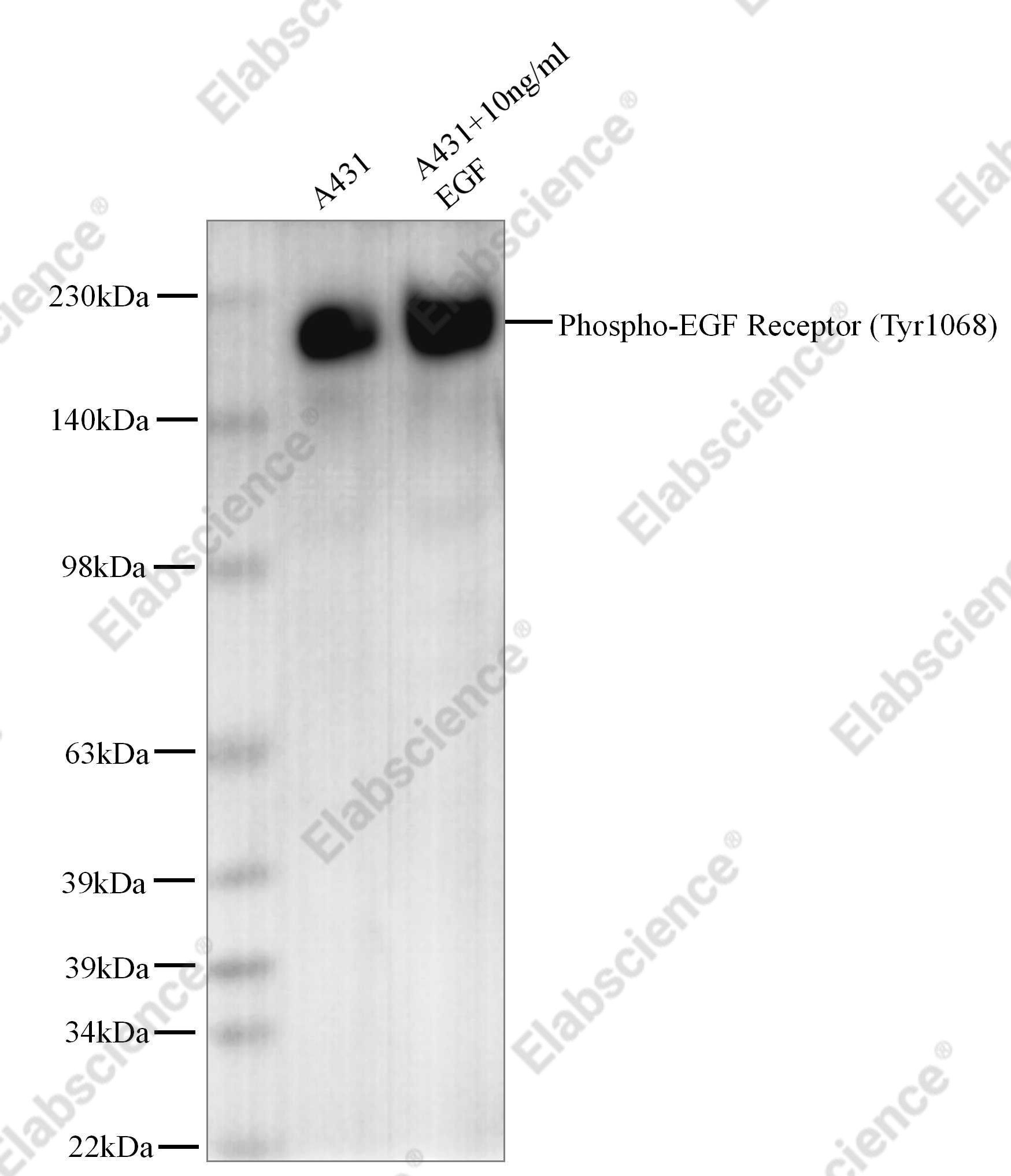 Recombinant Phospho-EGF Receptor (Tyr1068) Monoclonal Antibody - 1