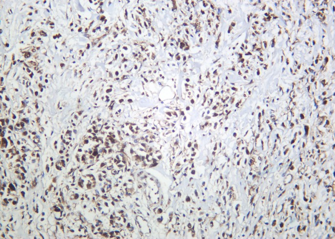 Recombinant ATP-Citrate Lyase Monoclonal Antibody - small - 2