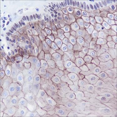 Recombinant TROP2 Monoclonal Antibody - 3