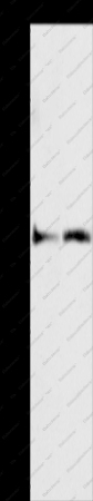 ASAH2 Polyclonal Antibody - 1