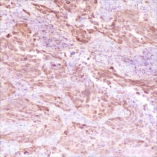 Recombinant Phospho-S6 Ribosomal Protein (Ser235, Ser236) Monoclonal Antibody - 3