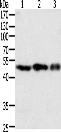 Western Blot analysis of NIH/3T3, 293T and Jurkat cell using F7 Polyclonal Antibody at dilution of 1:400